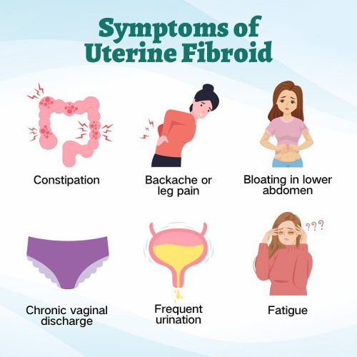 Symptoms of Fibroid