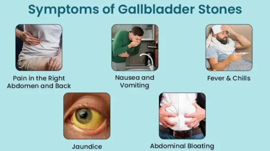 Symptoms of Gallbladder Stone