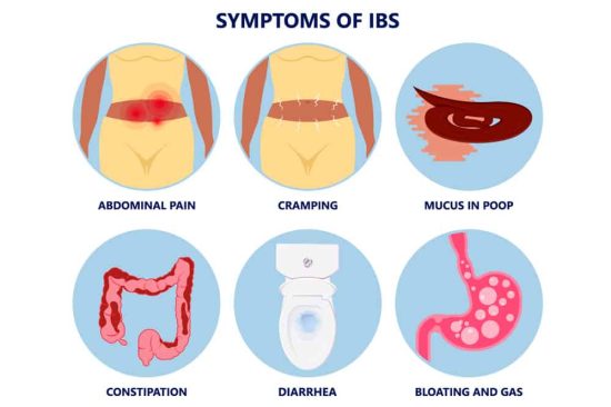 Symptoms of IBS