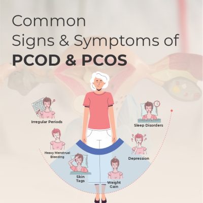 Symptoms of PCOS and PCOD