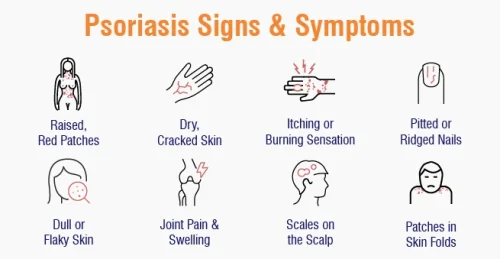 Symptoms of Psoriasis