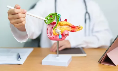 Understanding Gallbladder Stones