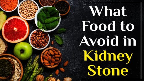 food to avoid in kidney stone