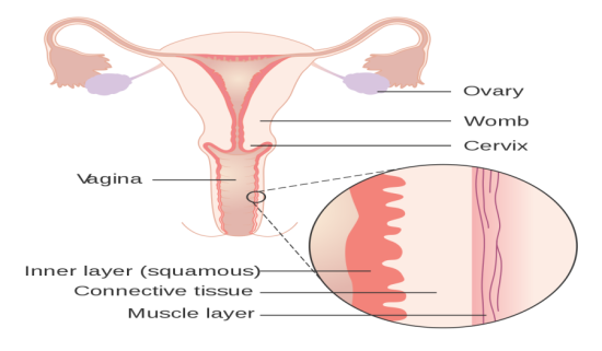 What is Leucorrhoea?