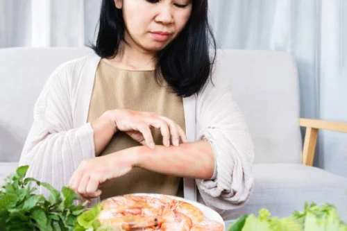 What is a Food Allergy?