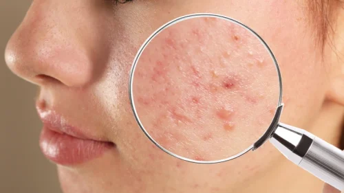 What is a Skin Issue?