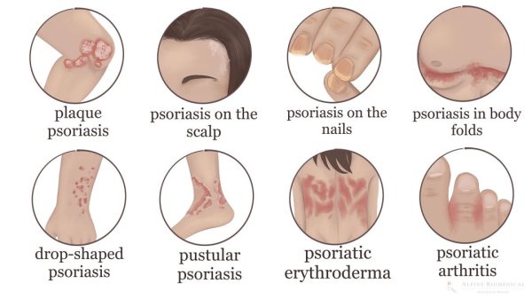 skin disease symptoms