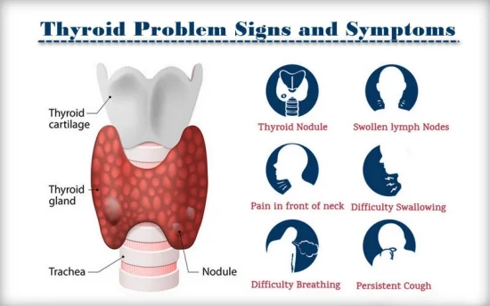 symptoms of thyroid
