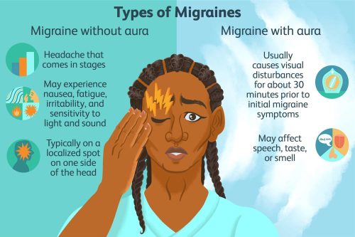 types of migraine